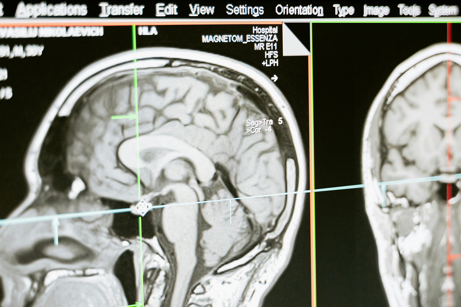 蛋白模擬仿生合成Gd:CuS造影劑用于體內腫瘤成像研究