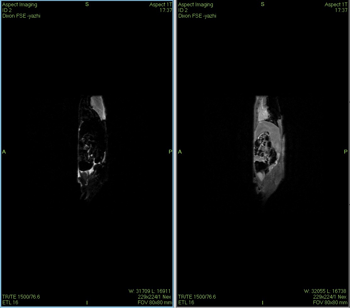 Dixon序列用于大鼠、小鼠水脂分離磁共振成像-脂肪抑制技術